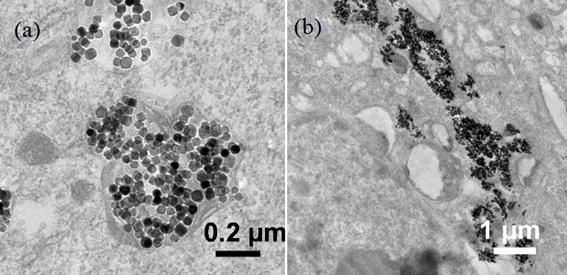 Agregados de nanopartículas para destruir células cancerosas