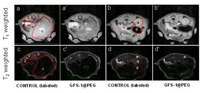 Desarrollan nanopartículas que mejoran el contraste en imágenes de resonancia magnética y facilitan el diagnóstico clínico
