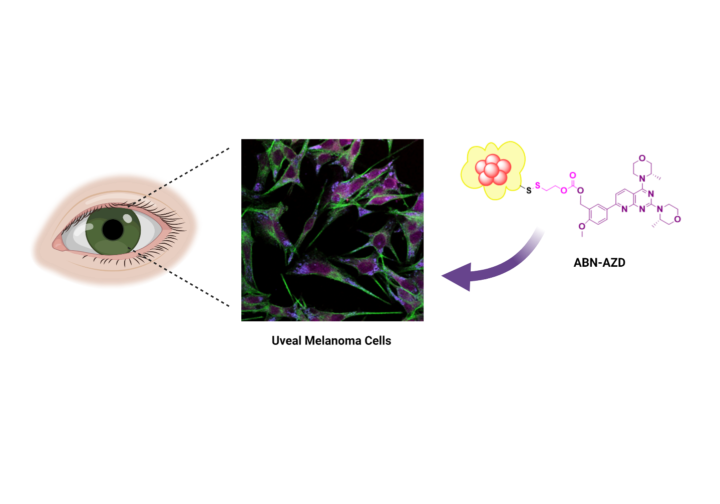 Nanopartículas inteligentes para combatir el cáncer de ojo más agresivo