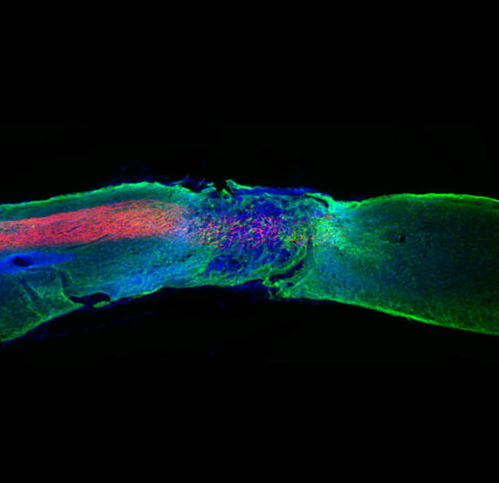 Logran recuperar la movilidad en ratones con graves lesiones medulares mediante una inyección de nanofibras