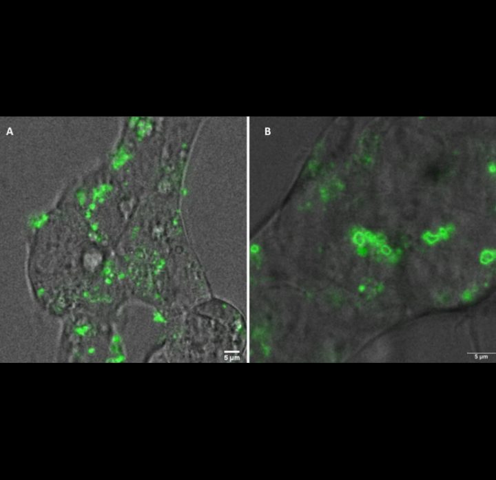 Nuevas nanovesículas fluorescentes para detección intracelular de biomarcadores